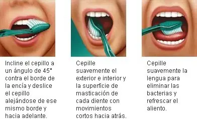 Bucales Bucales