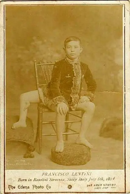 frank lentini