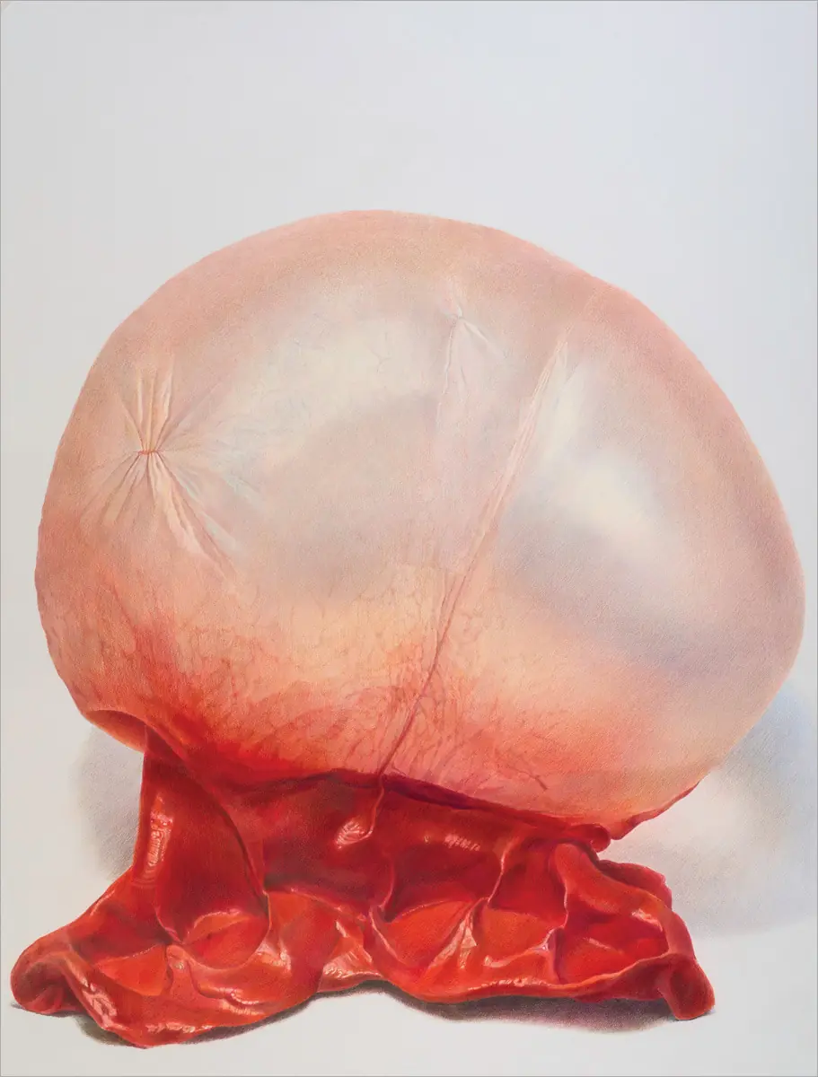 Surrealismo
