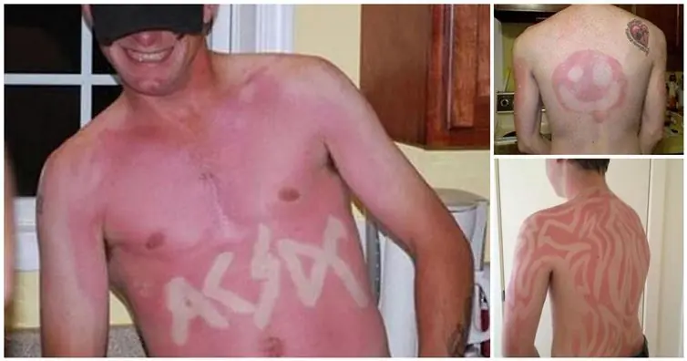 sunburn tattoos sunburn tattoos