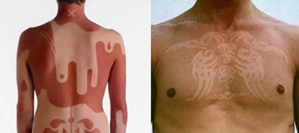 como hacer un tatuaje de quemadura solar como hacer un tatuaje de quemadura solar