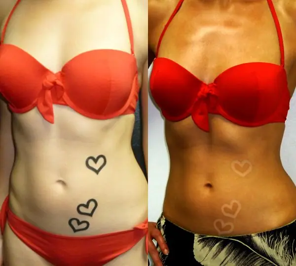 como hacer un tatuaje de quemadura solar como hacer un tatuaje de quemadura solar