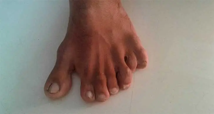 pies