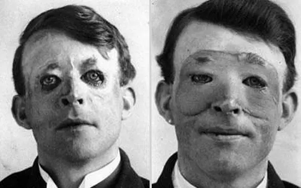 5 fotos historicas