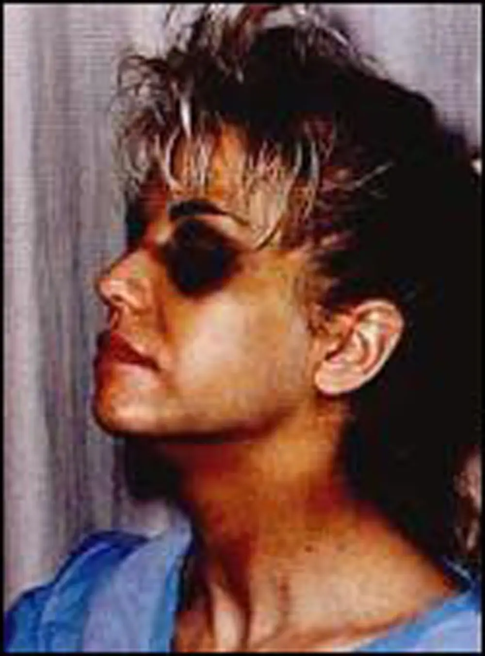 homolka homolka
