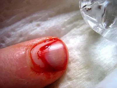 sangre