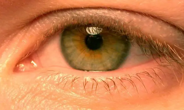 ¿Por qué los ojos se ponen rojos?