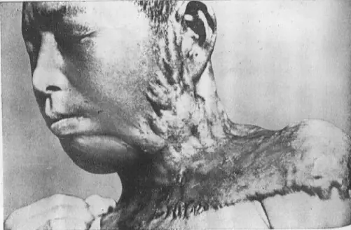 Hiroshima: fotos aterradoras y la historia oculta