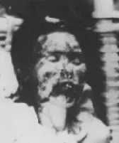 hiroshima bomba