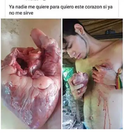 Imagenes