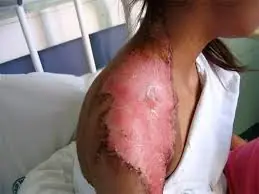 Que Pasaria Si Desapareciera Todo El Oxigeno Por 5 Segundos?