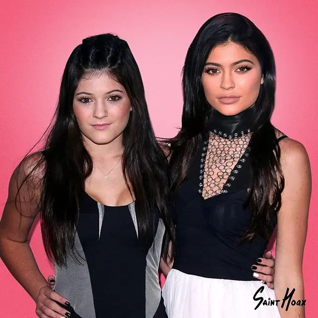 las cirugias de las kardashian las cirugias de las kardashian