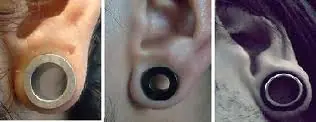 expansores