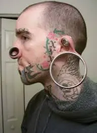expansores