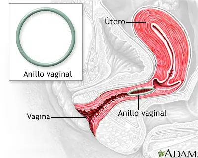 Anticoncepcion (con graficos)