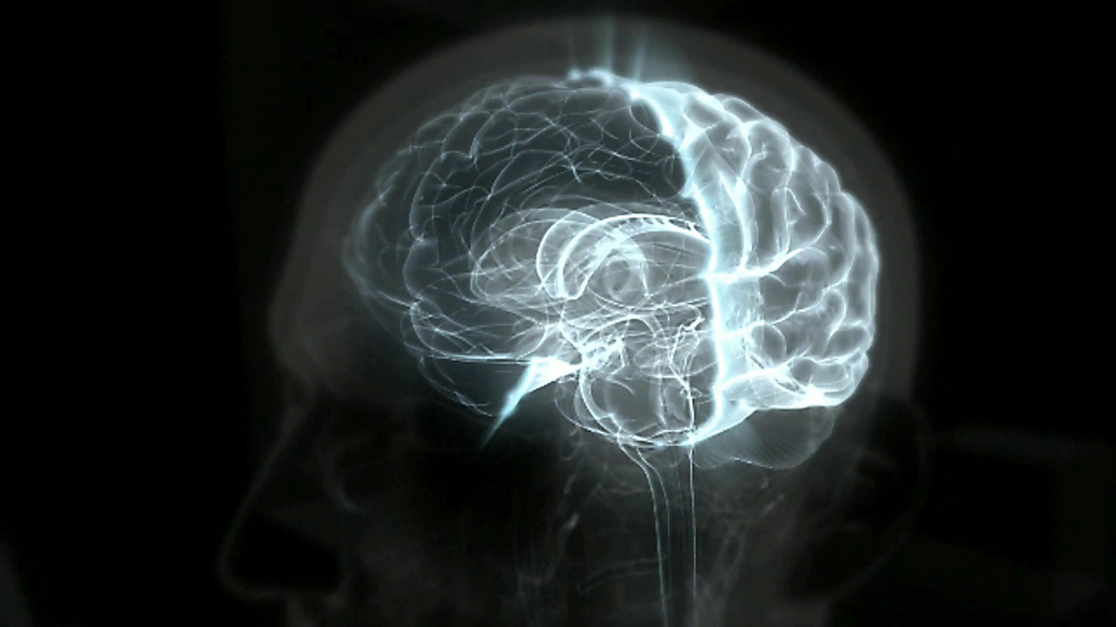 cerebro cerebro