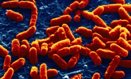 Bacterias: Conjugación, Transducción y Transformación