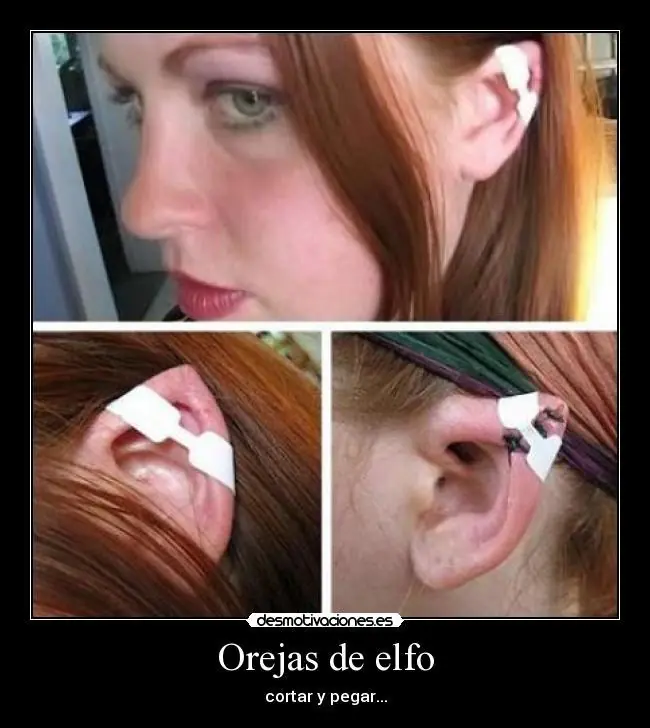 Elfo Sanguinario yo te Banco