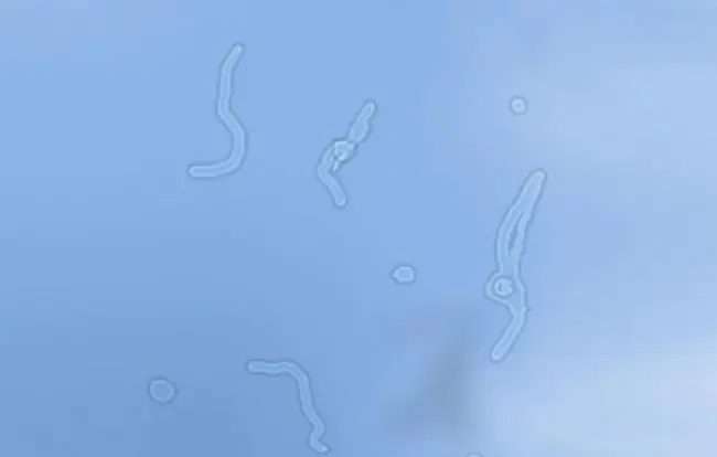 ¿Que son esas cosas transparentes que flotan ante los ojos?