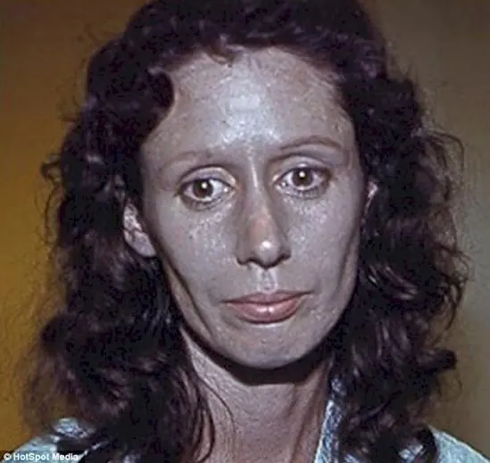 Remedios
