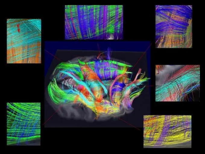datos del cerebro