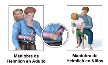 heimlich