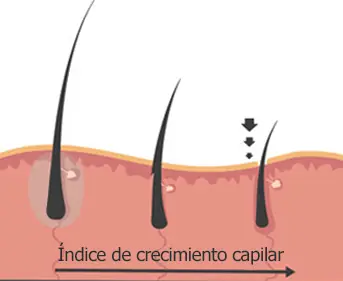 de las barbas