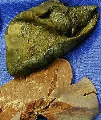 medicina