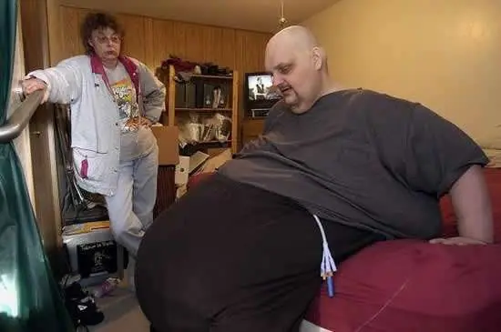 bypass gastrico
