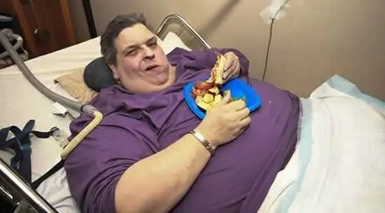 obesidad morbida