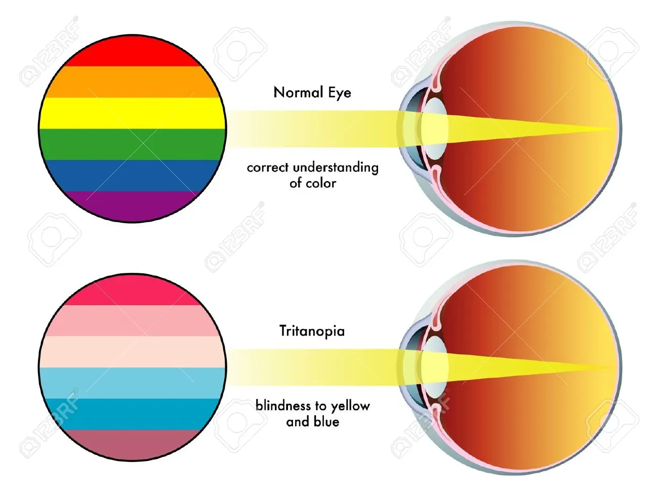 Ojos Ojos