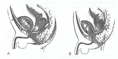 anomalia anomalia