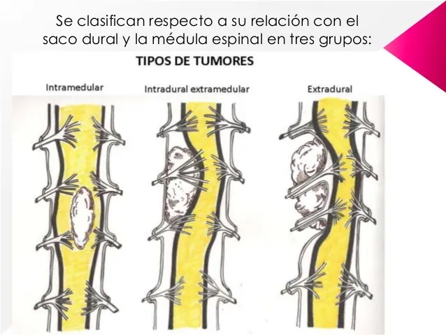 par craneal 8