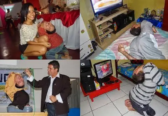 malformaciones congenitas