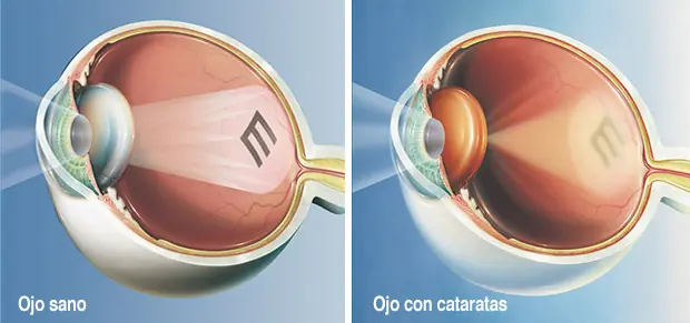 diagnostico
