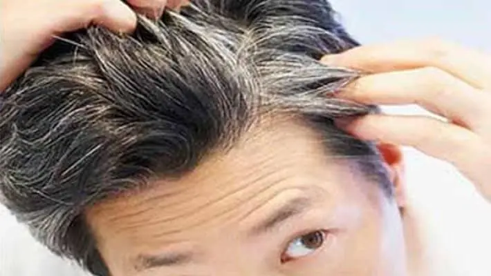 ¿Tienes canas? entra