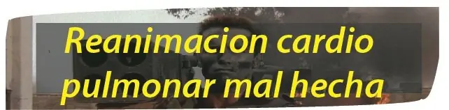 rcp
