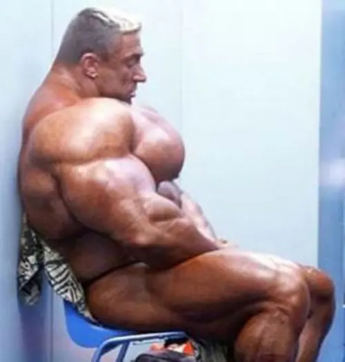 vigorexia
