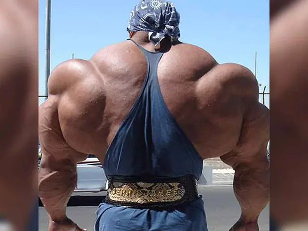 vigorexia