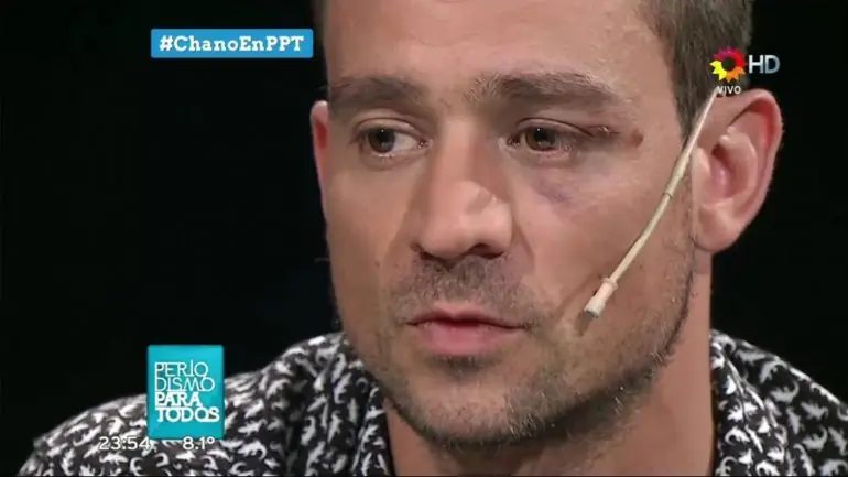 Chano
