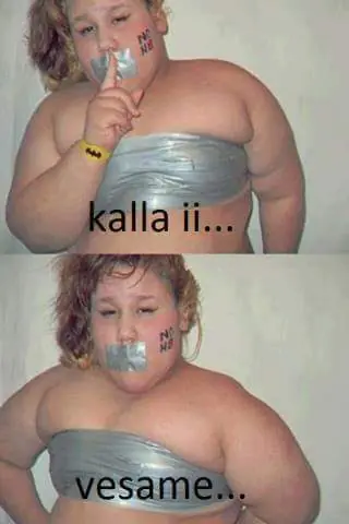 Subdesarollo