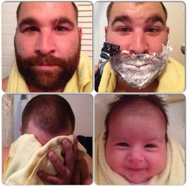 imagenes antes y despues imagenes antes y despues