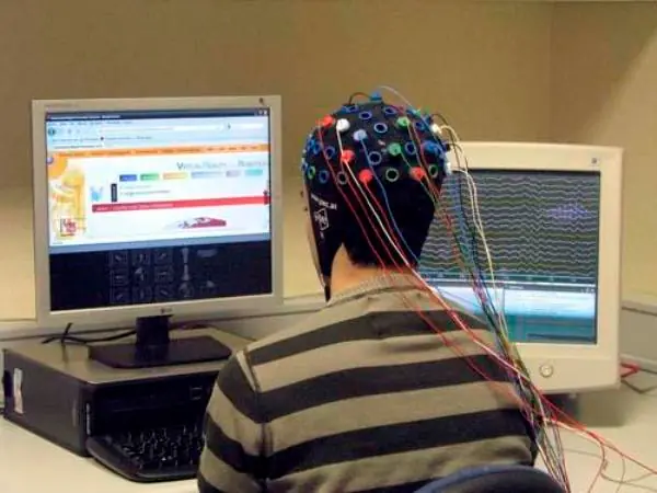 neurologia