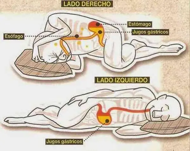 izquierdo