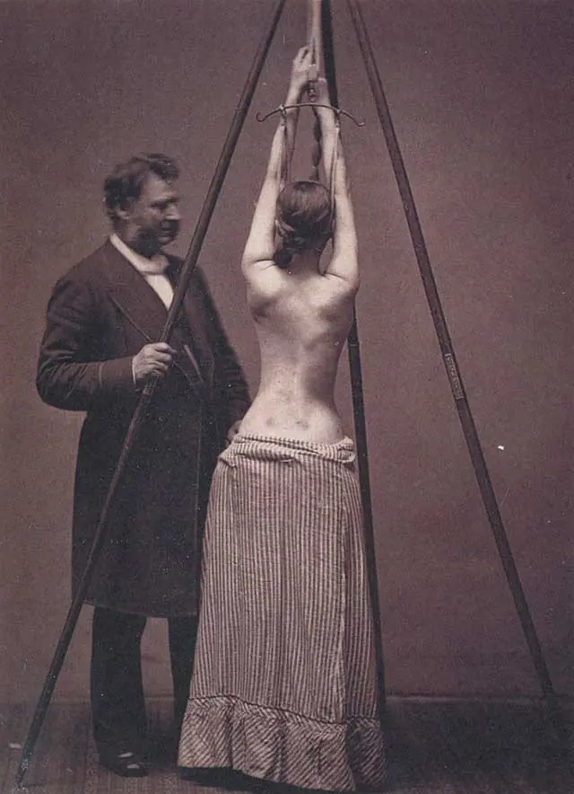 Fotos Médicas Tétricas antiguas, en los siglos pasados.