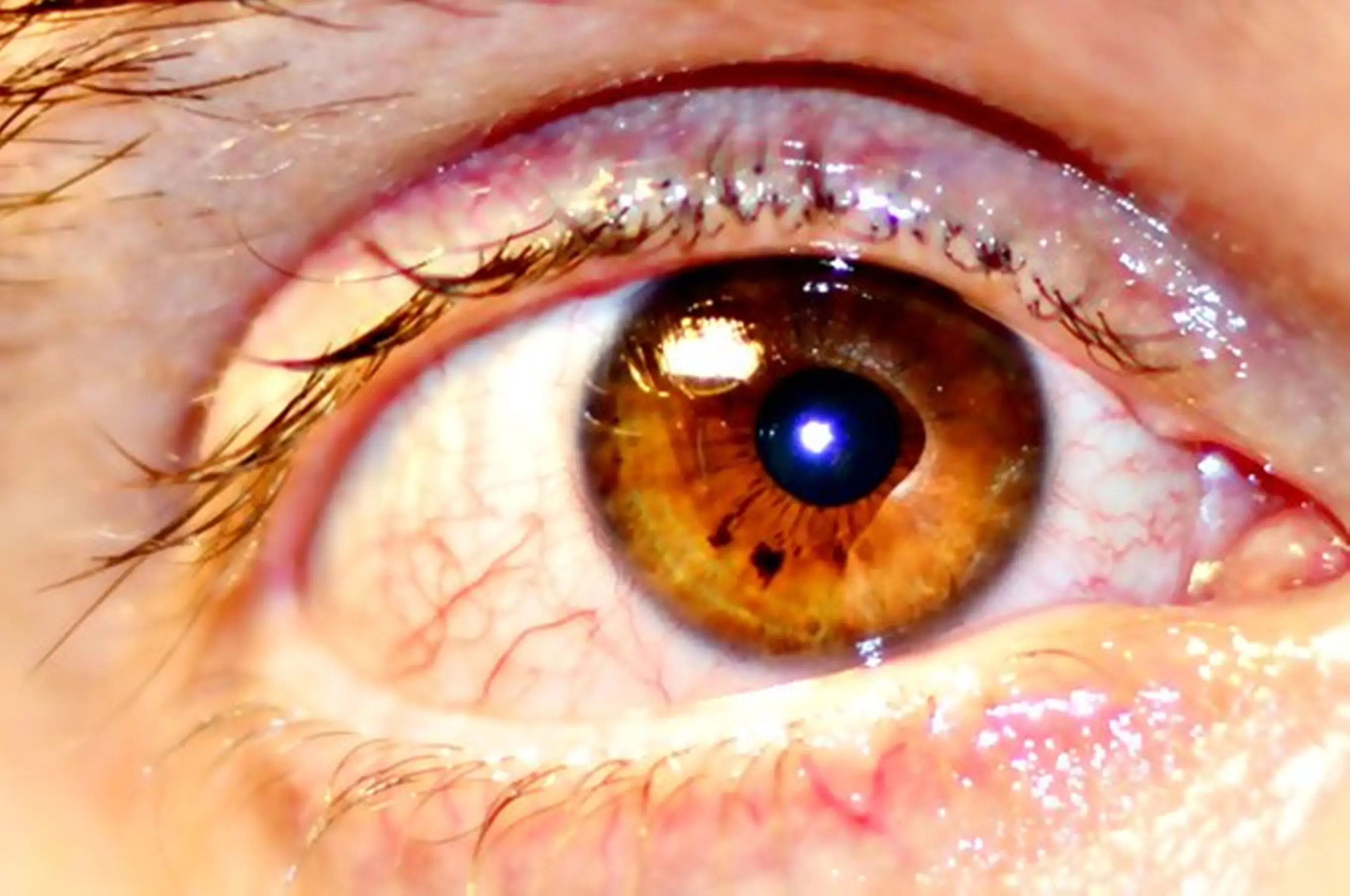 ojo