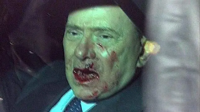 Papu