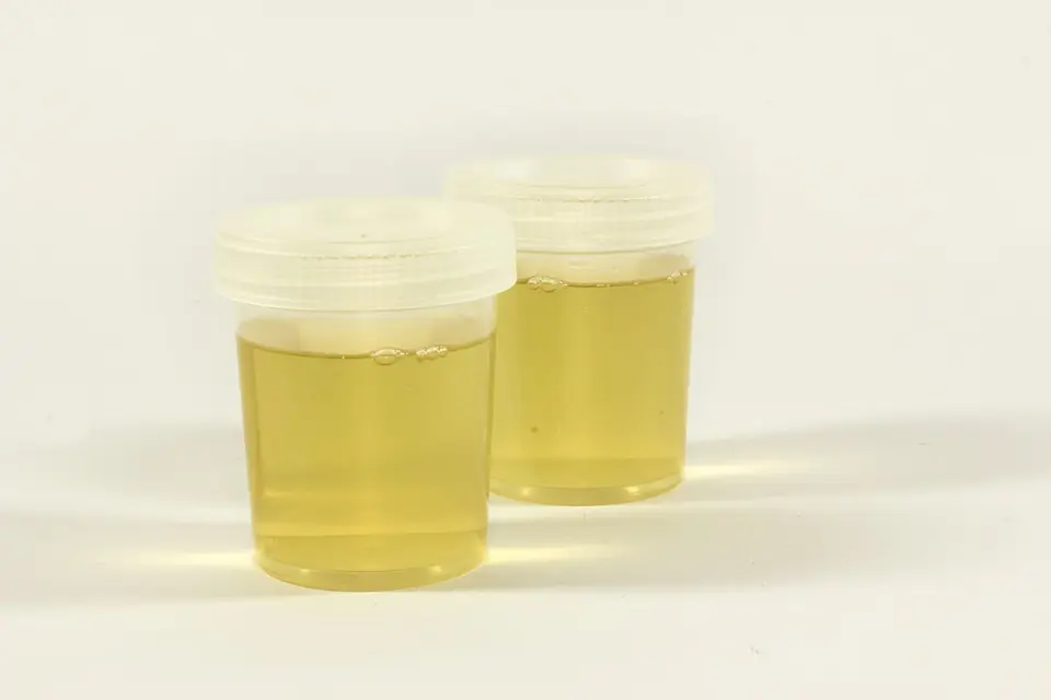 el color