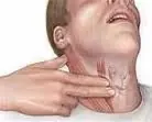 cuello