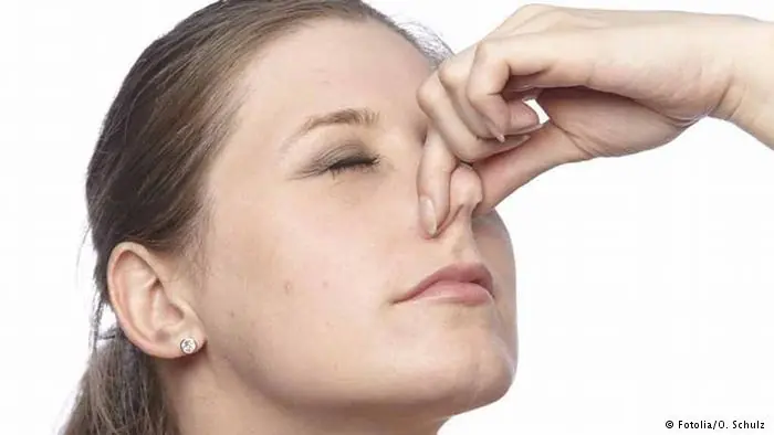 hemorragia nasal